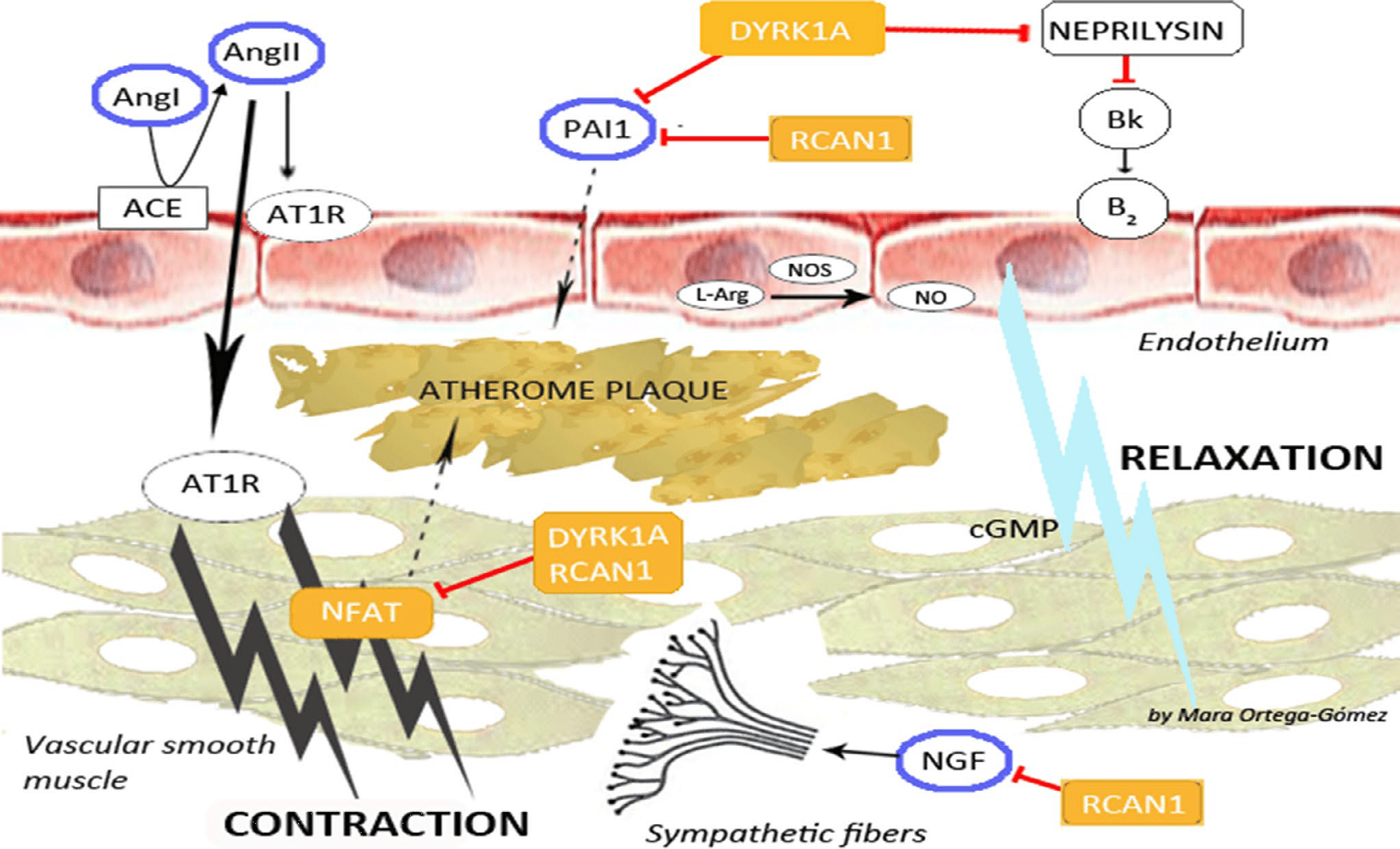 Posibles mecanismos moleculares del control de la presión arterial en personas con síndrome de Down