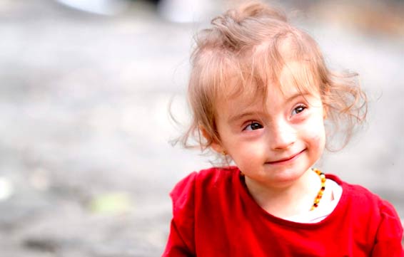 "El UP Síndrome del Amor" - “The UP Syndrome of Love"