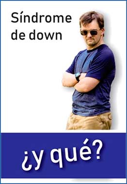 Síndrome de Down, ¿Y qué?