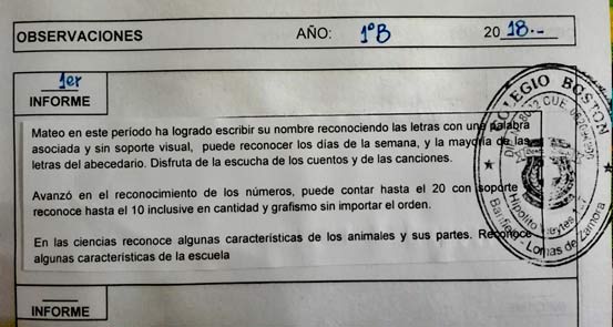 Sindrome de Down Mateo