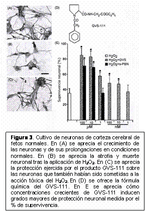 envejecimiento precoz de las personas con síndrome de Down