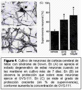 envejecimiento precoz de las personas con síndrome de Down