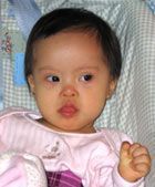 ¿Por qué se sale la lengua?