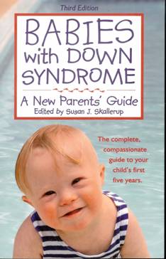 Babies with Down syndrome. A new Parent’s Guide. 3ª edic.