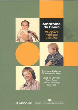 Síndrome de Down: Aspectos médicos actuales