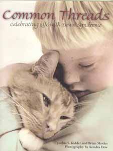 Common Threads: Celebrating life with Down Syndrome