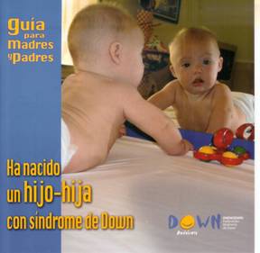 Ha nacido un hijo-hija con síndrome de Down.