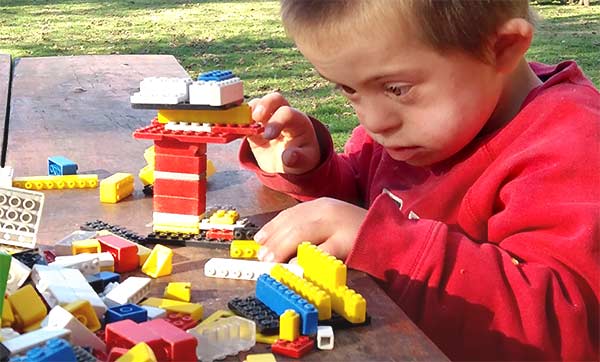 la atención del niño con síndrome de Down