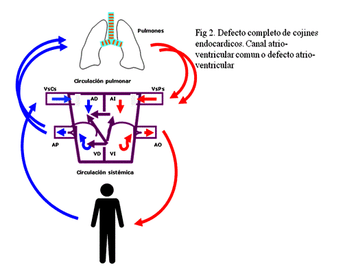 Canal atrioventicular.