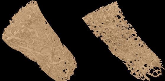 Fragmentos de hueso analizados mediante microTAC. Izquierda: hueso normal; derecha: hueso osteoporótico.