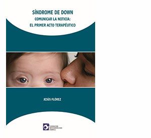 resultado de imagen síndrome de Down