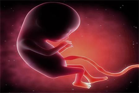 Diagnóstico prenatal en el síndrome de Down