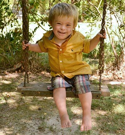 sindrome-de-down